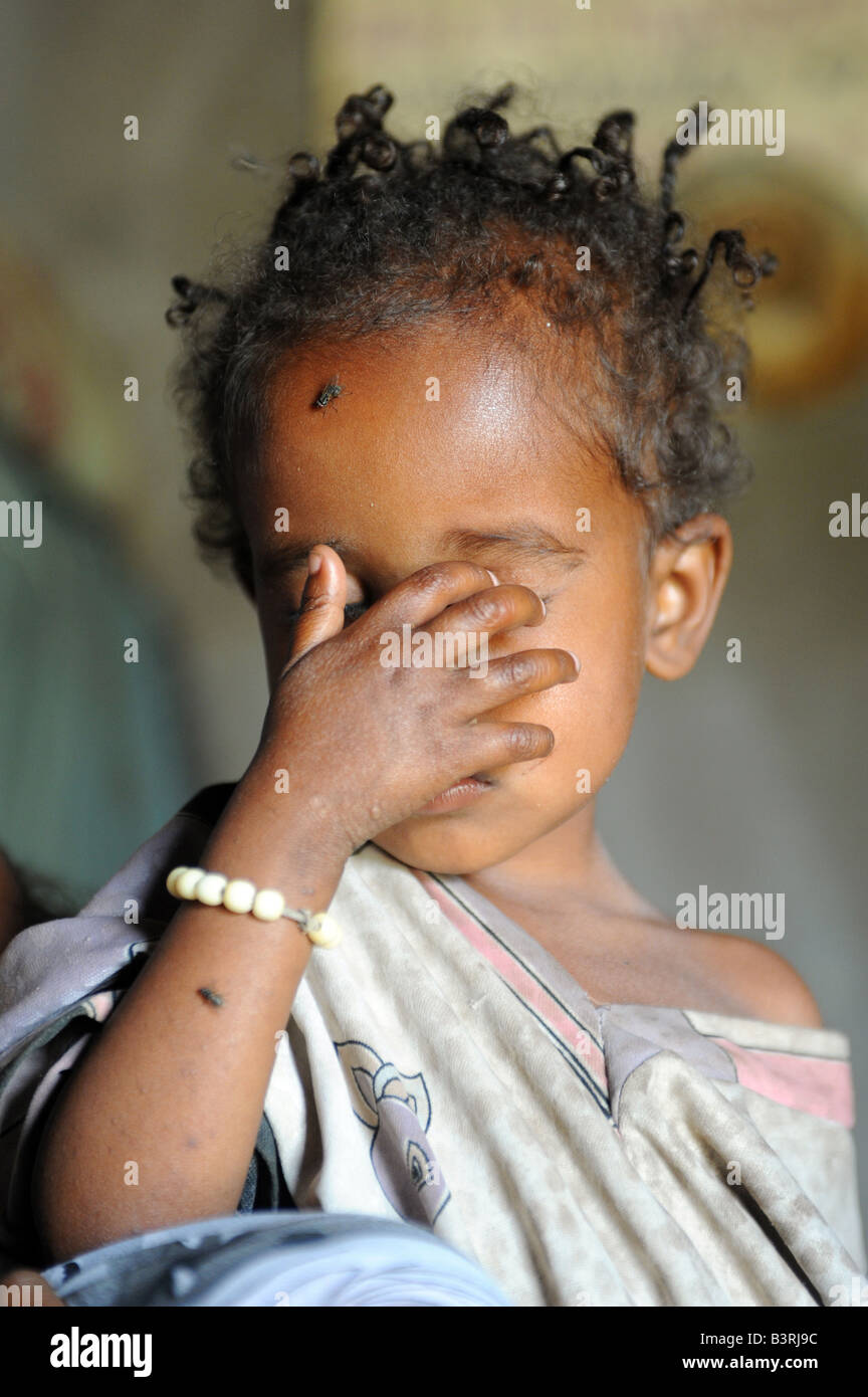 Elfinish Jemal 4 who had been recieving Concern food aid in Mareko Woreda Southern Ethiopia Stock Photo