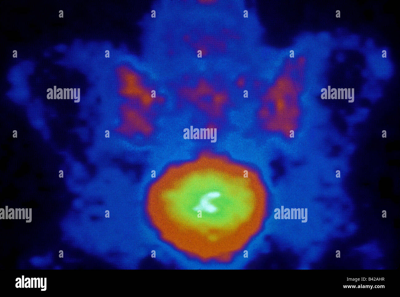 pelvis diagnostic imaging Stock Photo