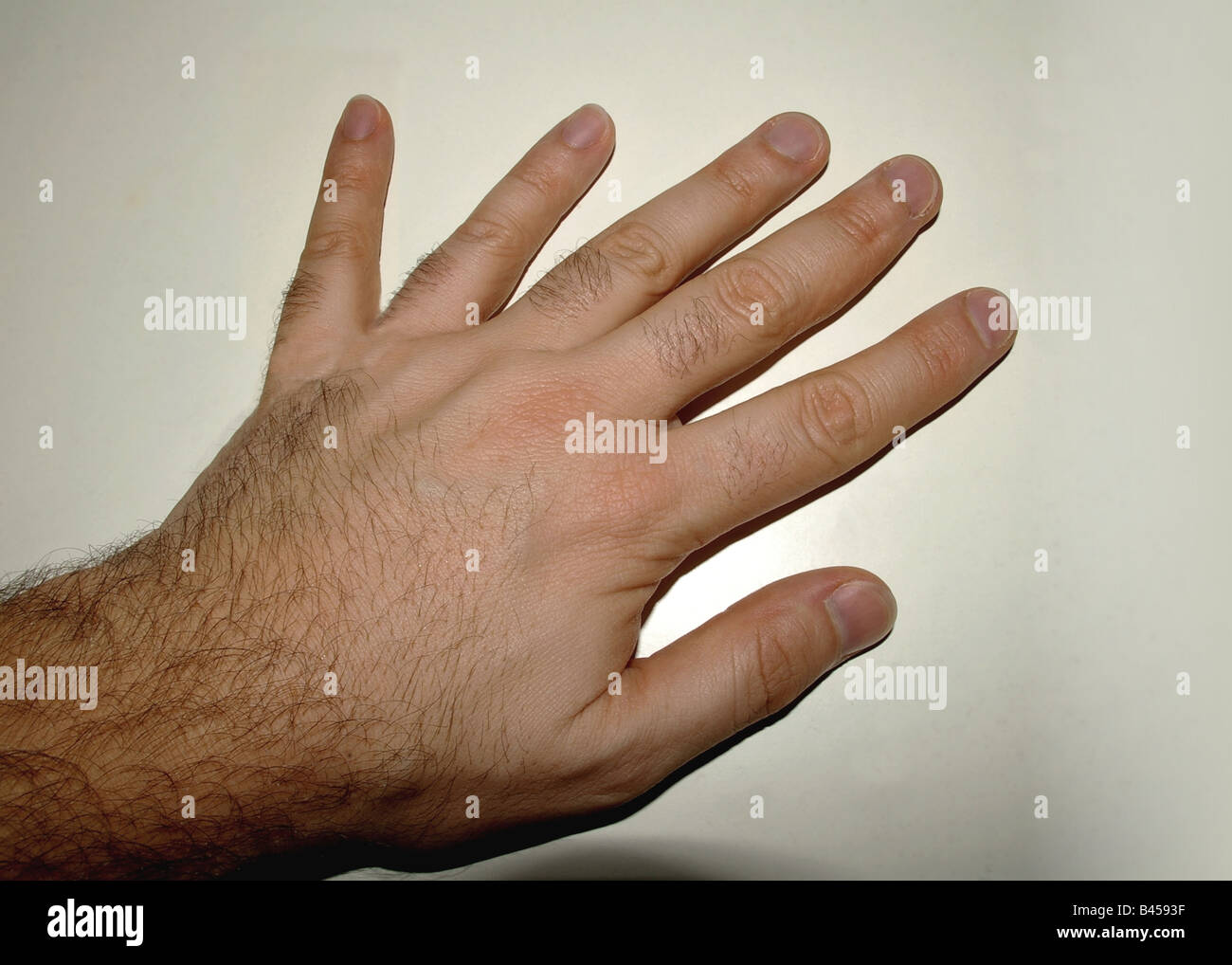 Six fingered hand Stock Photo
