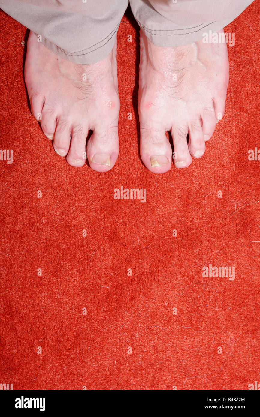 Mans feet and toes Stock Photo