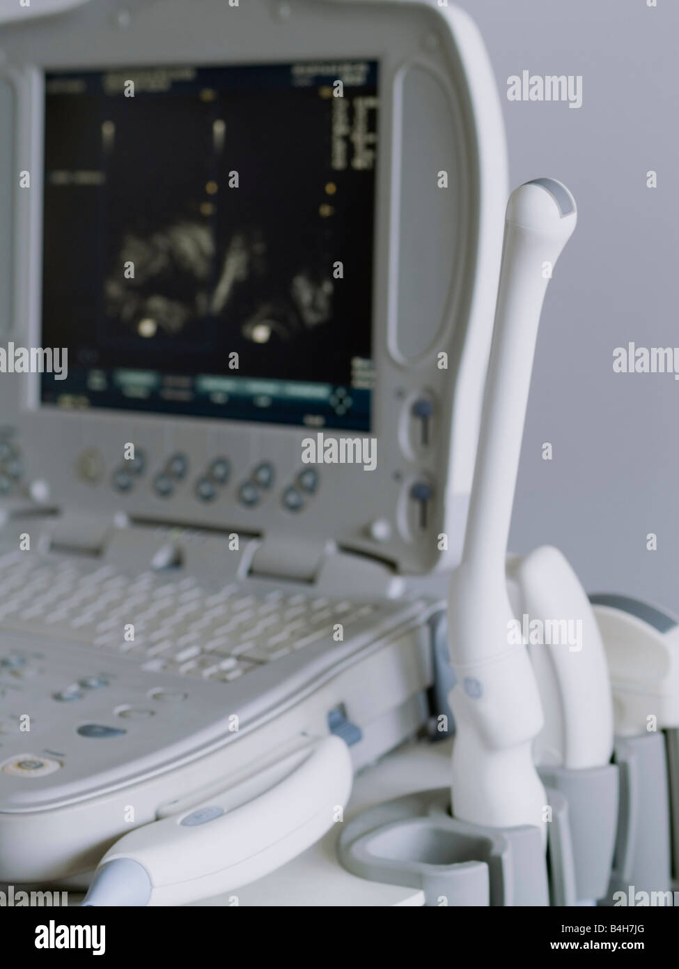 Ultrasound photographs hi-res stock photography and images - Alamy