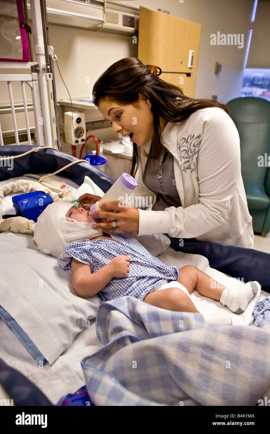 In a California hospital a mother cares for her infant son suffering from spinal bifida Note condition monitoring EEG Stock Photo