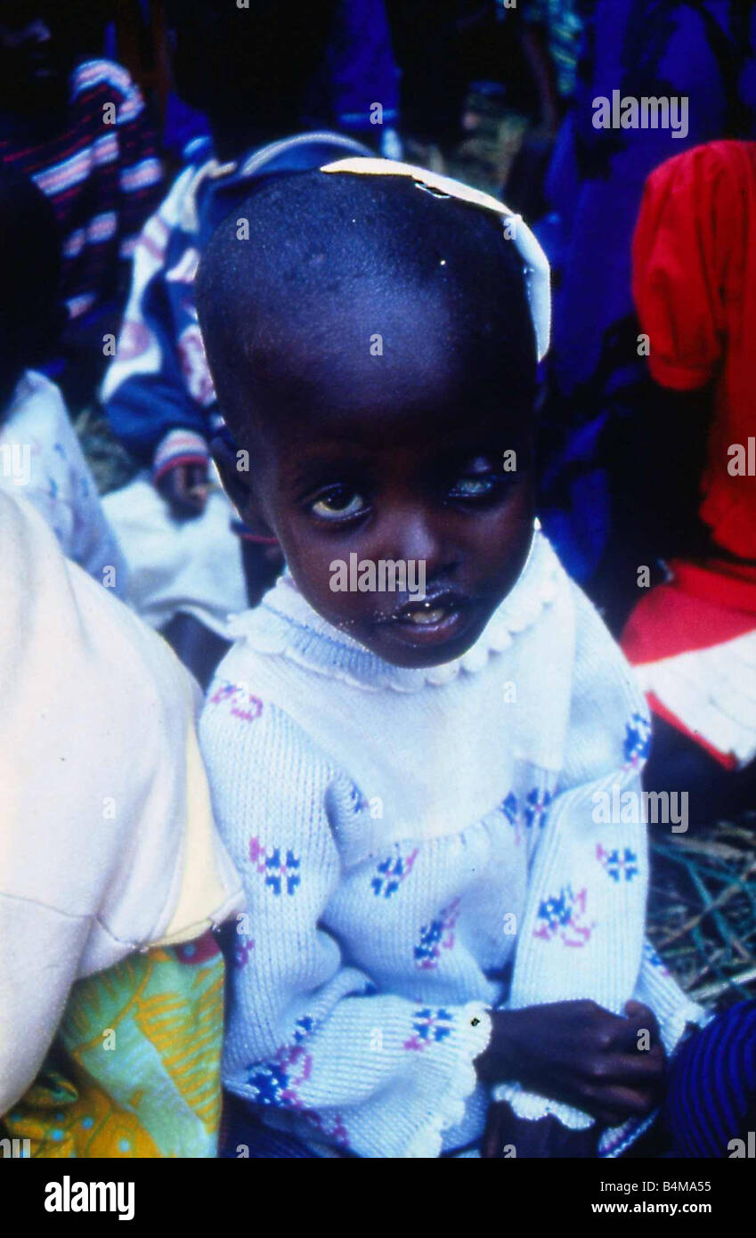 A small girl recovering from the effects of famine and war in Rwanda July 1994 Mirrorpix Stock Photo