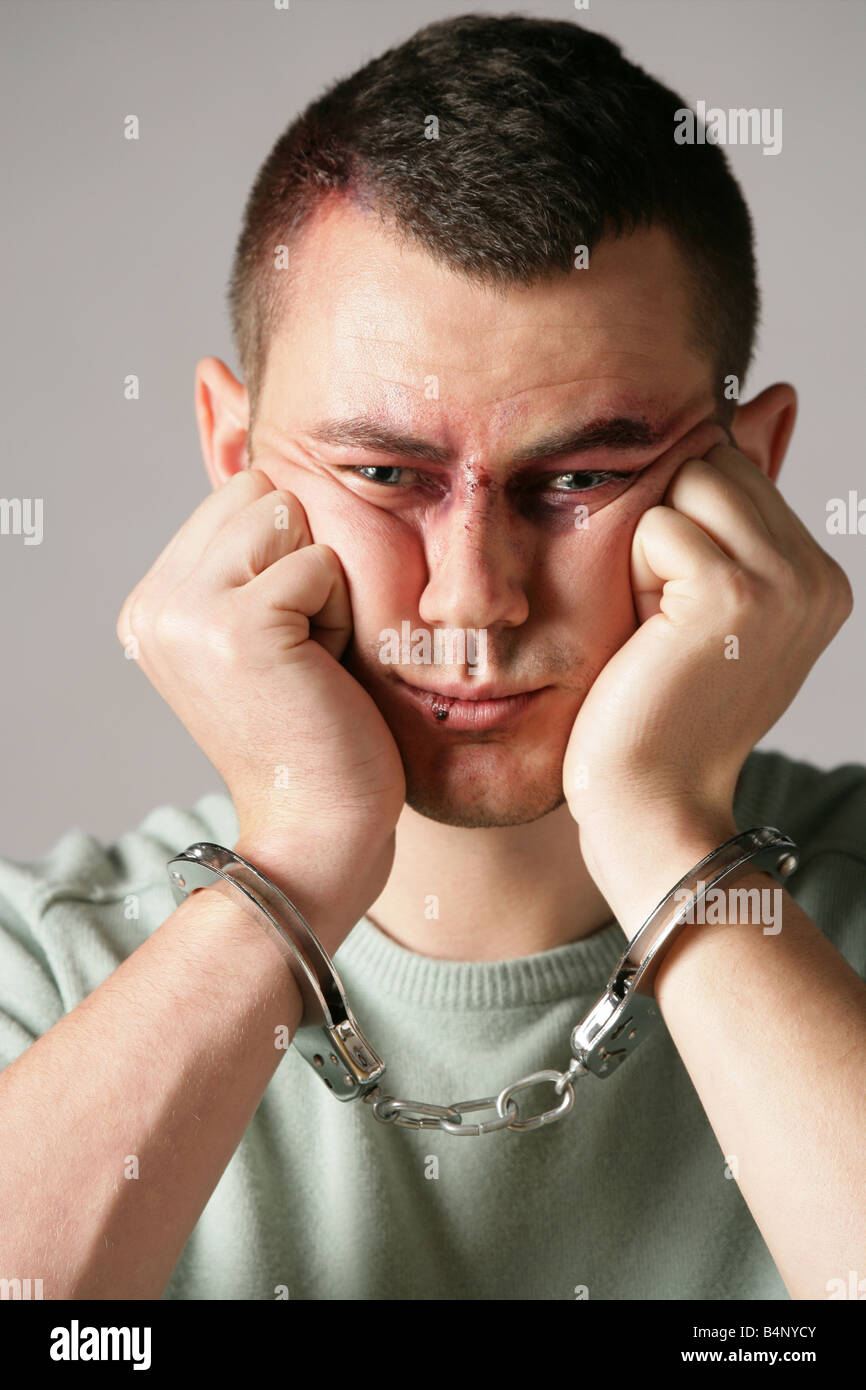 “Male model James with a fake black eye applied by make up artist and wearing hand cuffs” Stock Photo