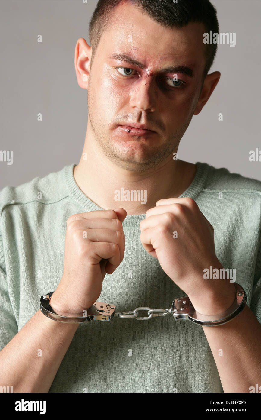 “Male model James with a fake black eye applied by make up artist and wearing hand cuffs” Stock Photo