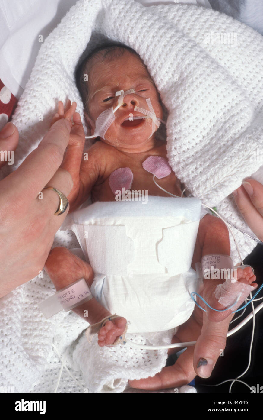tiny premature baby in incubator attached to tubes Stock Photo
