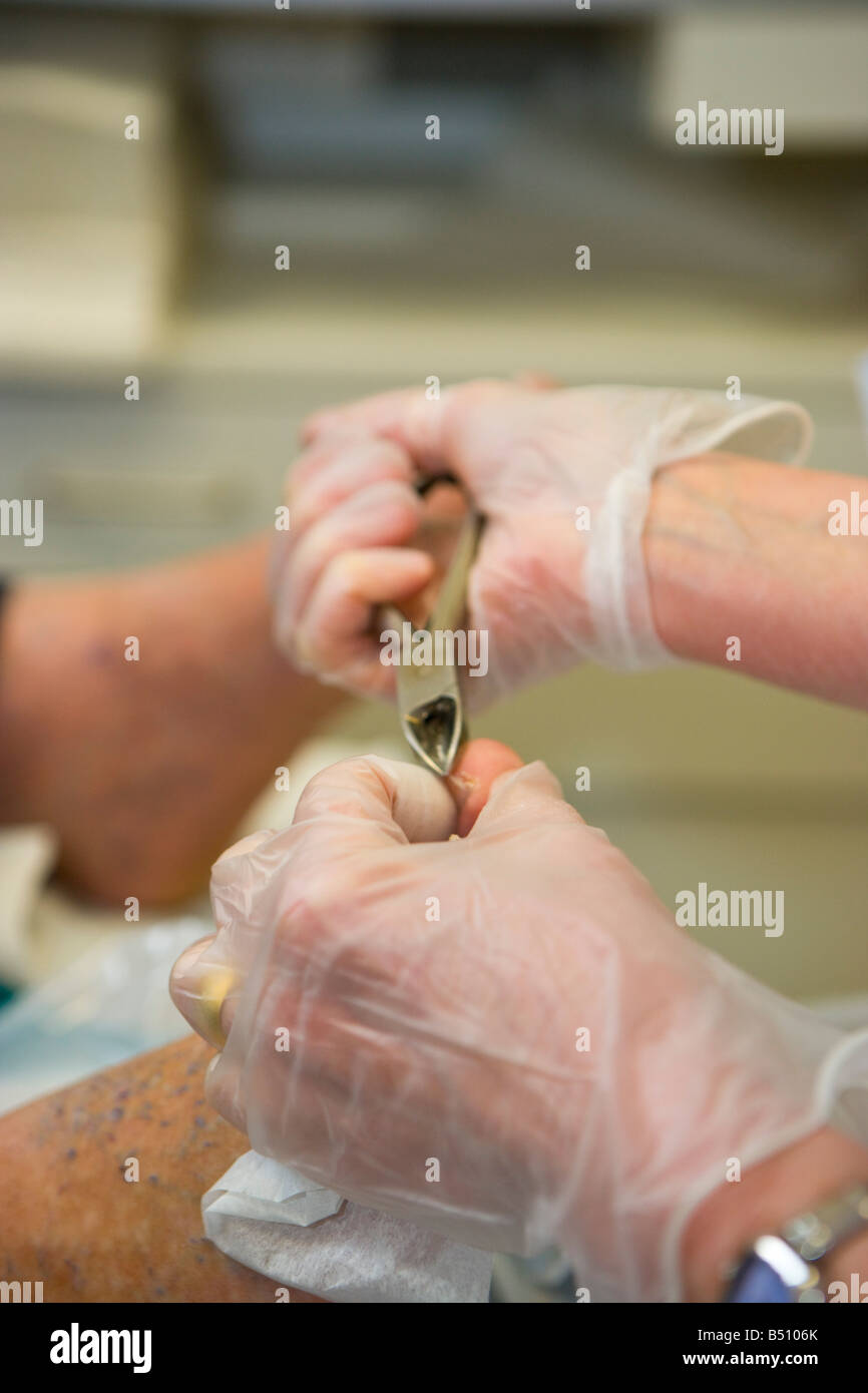Cutting toe nails hires stock photography and images Alamy