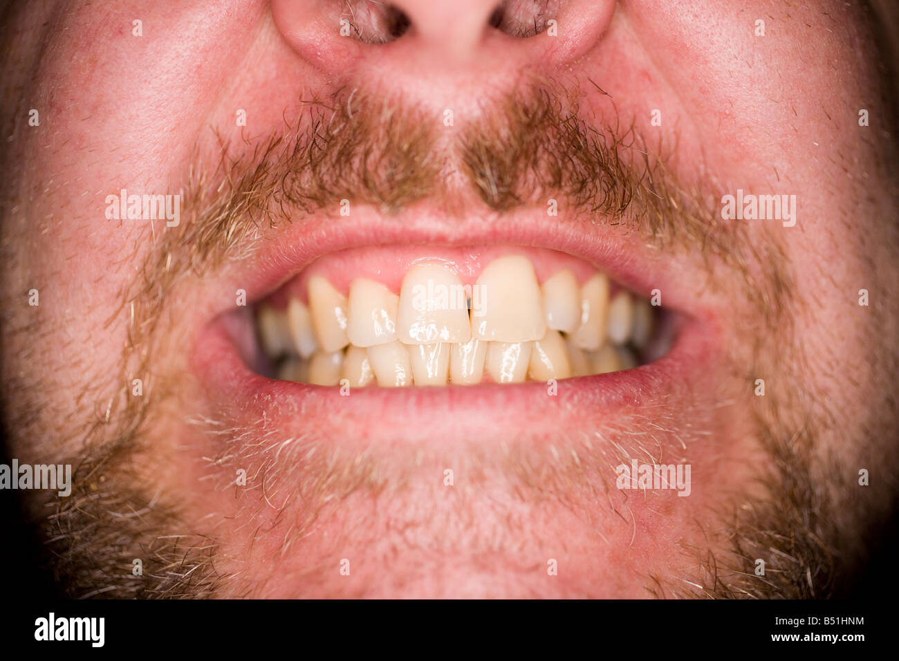 Man with a beard shows teeth Stock Photo