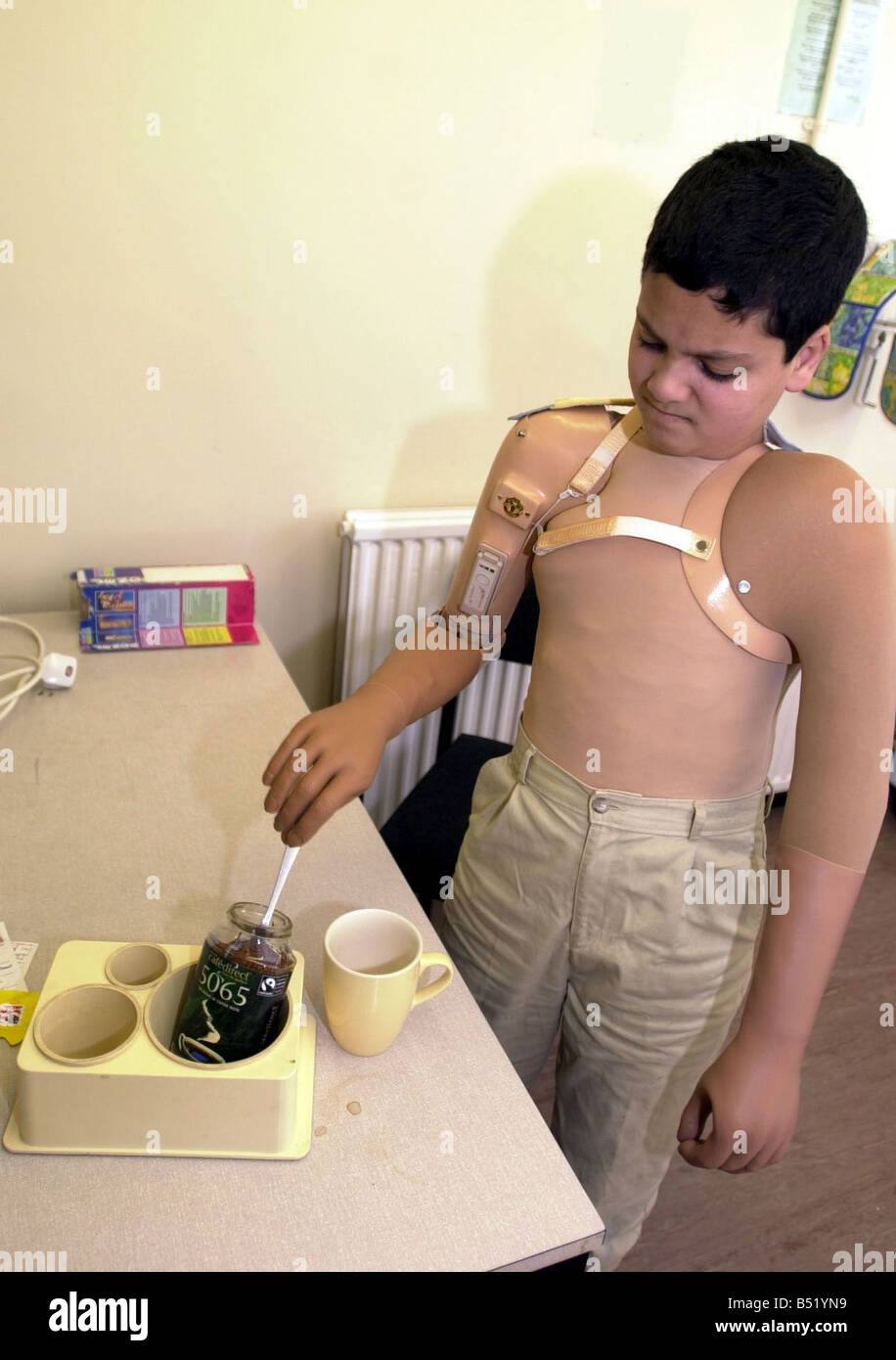 Ali Abbas who lost both arms and suffered terrible burns during the bombing  of Baghdad in the Iraq War making coffee while undergoing occupational  therapy at St Mary s Hospital October 2003