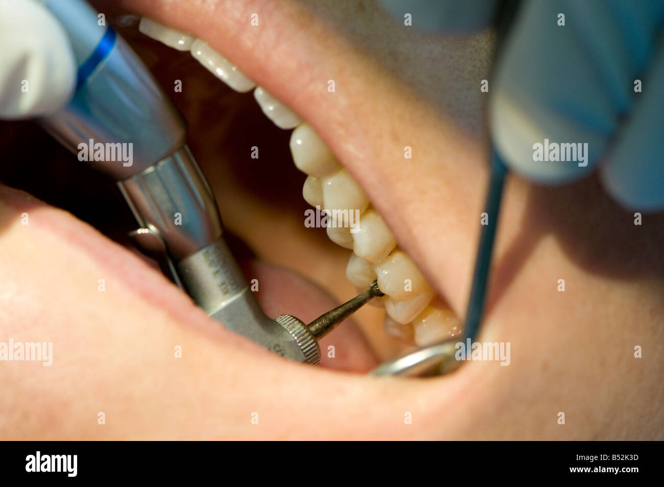 Cony Caravot dentist at Nigel Meyer Associates South Molton Street London Dental surgery Stock Photo
