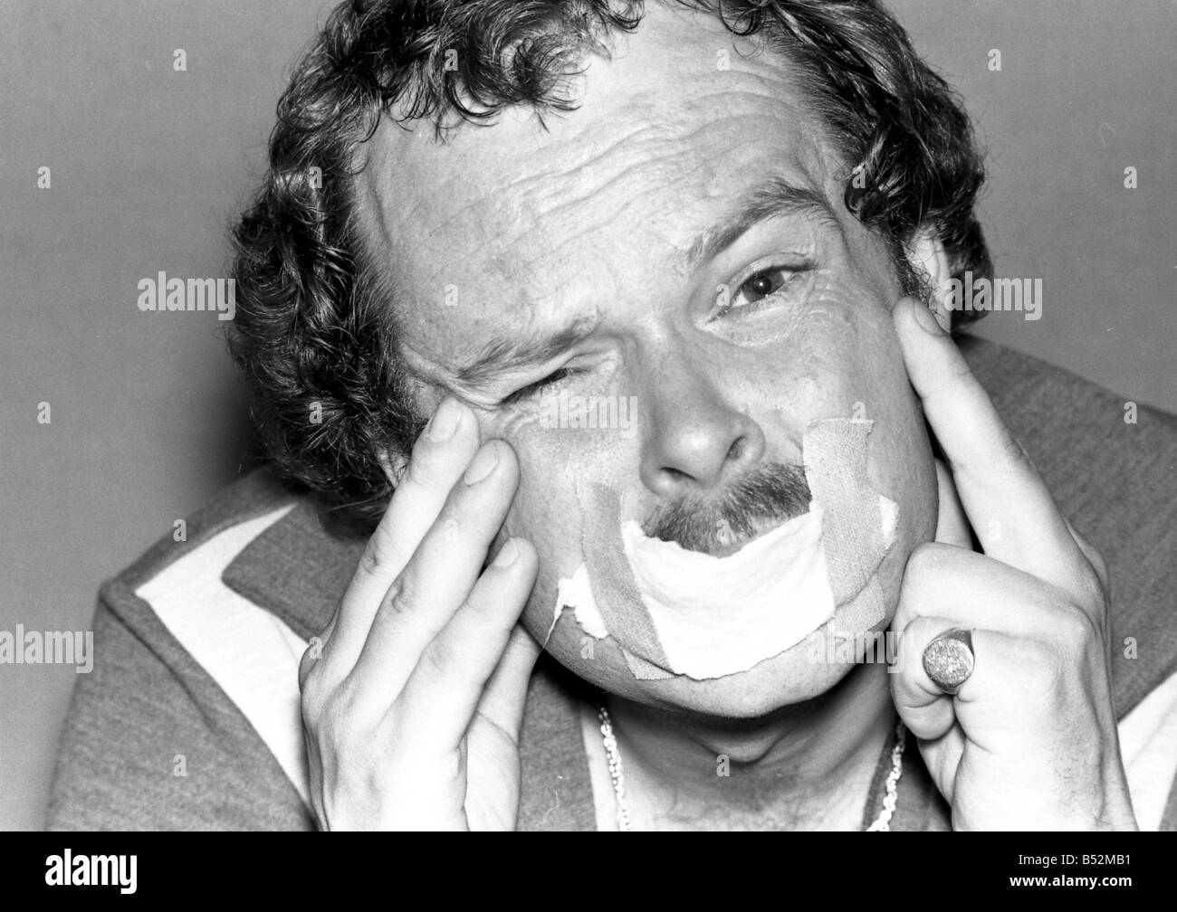 James Whale feeling sore after he had kissed 4,049 girls in eight hours creating a new world record. The Newcastle upon Tyne DJ Stock Photo
