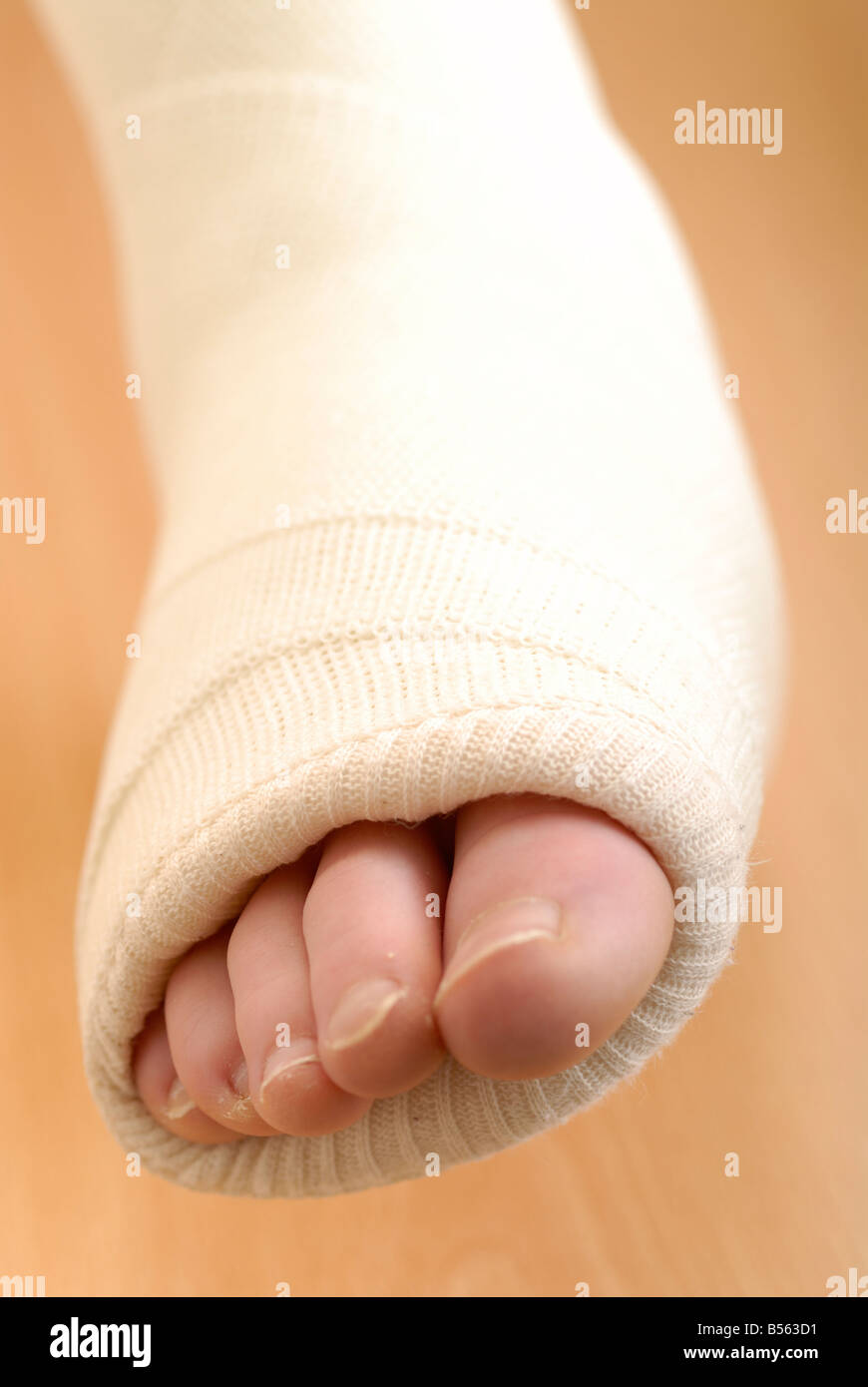 Plastered foot hi-res stock photography and images - Alamy