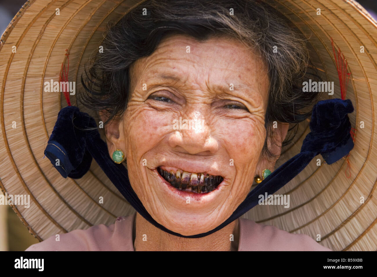 Smiling Vietnamese woman with teeth and lips stained from chewing betel
