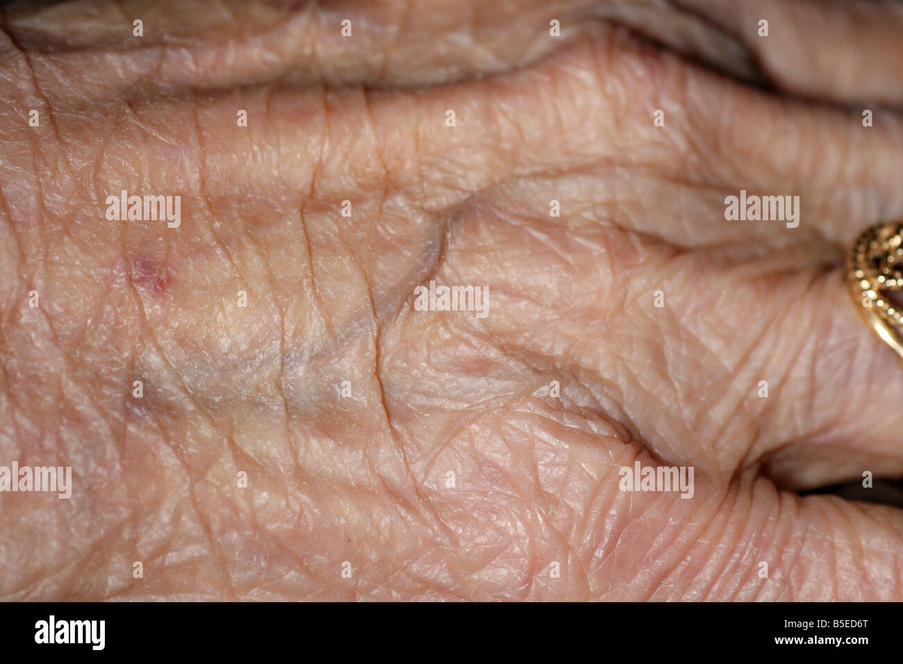 the skin on the hand of an elderly old woman Stock Photo
