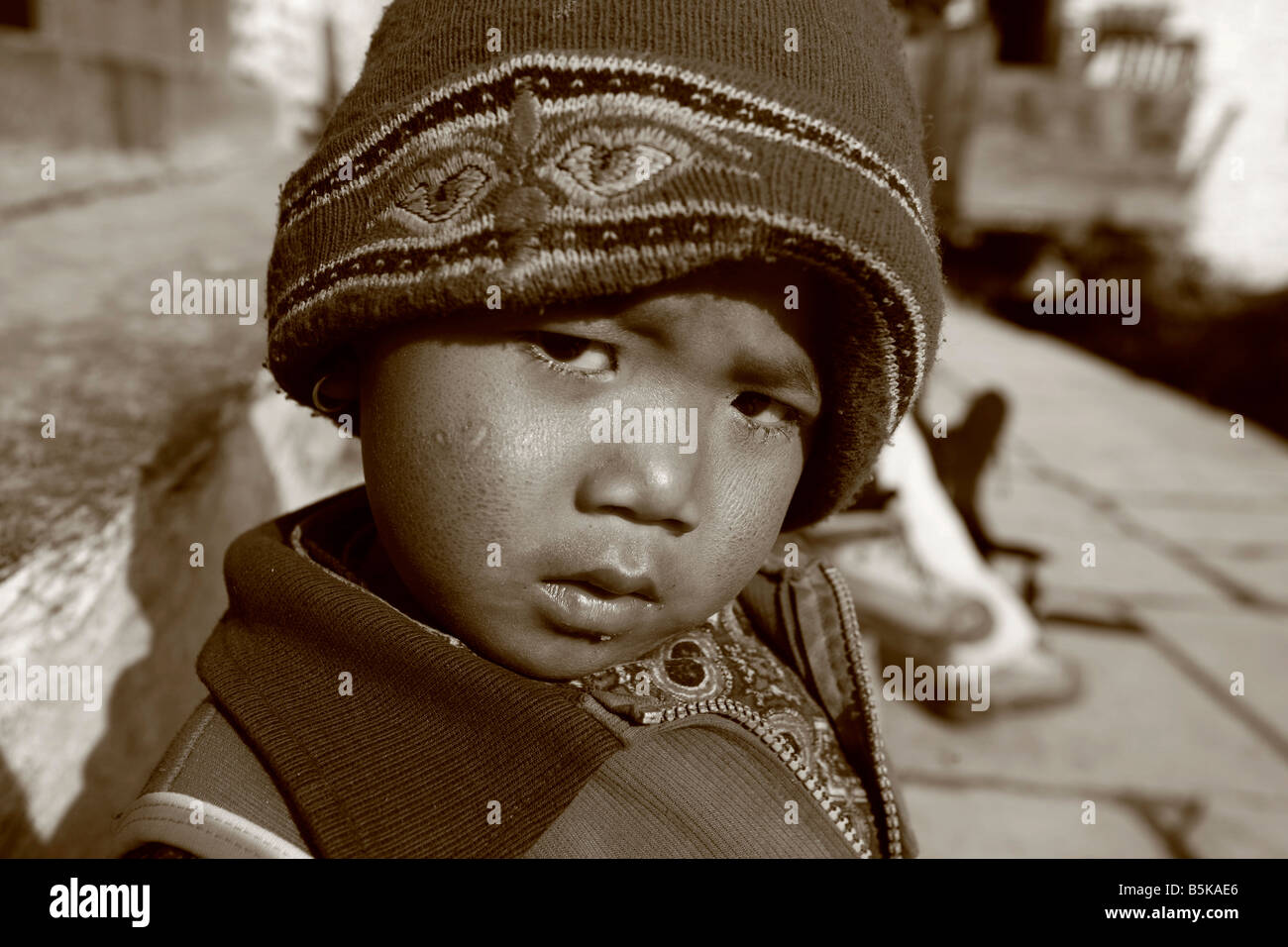 March 2008 Annapurna Nepal Portrait of young gurung boy with cap and dry skin Stock Photo