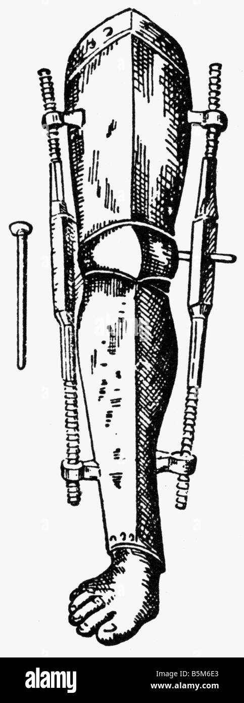 medicien, anatomy, artificial limbs, leg prothesis of Ambroise Pare, copper engraving, 16th century, Stock Photo