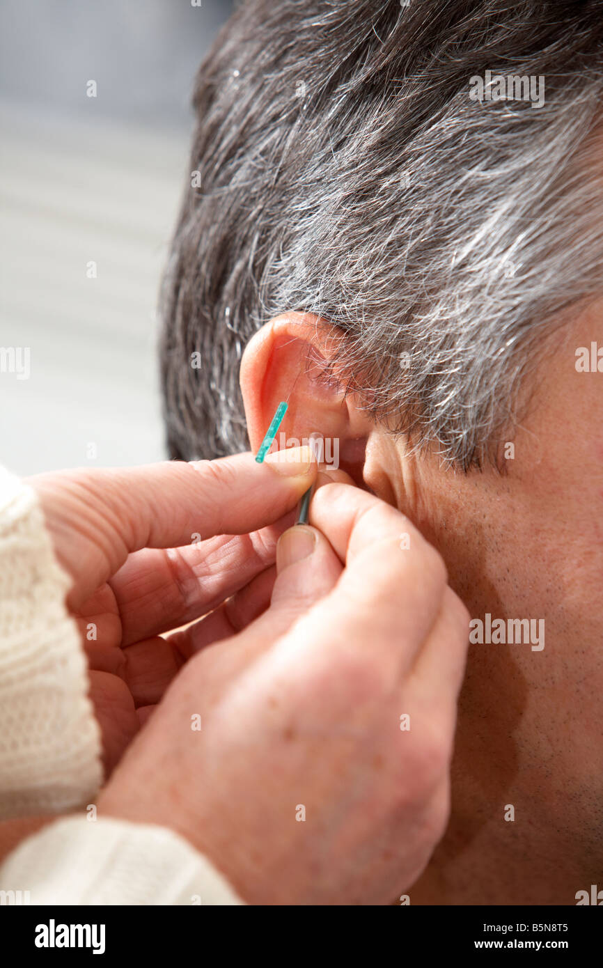 female acupuncturist applying acupuncture needles on the ear of an adult man fifties traditional chinese medicine complementary alternative therapy Stock Photo