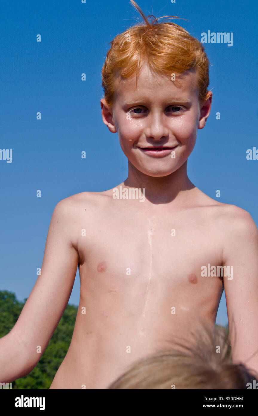 Miracle boy, after having three aorta valve transplants,this ten year old enjoys life,on a summer day at the lake . Stock Photo