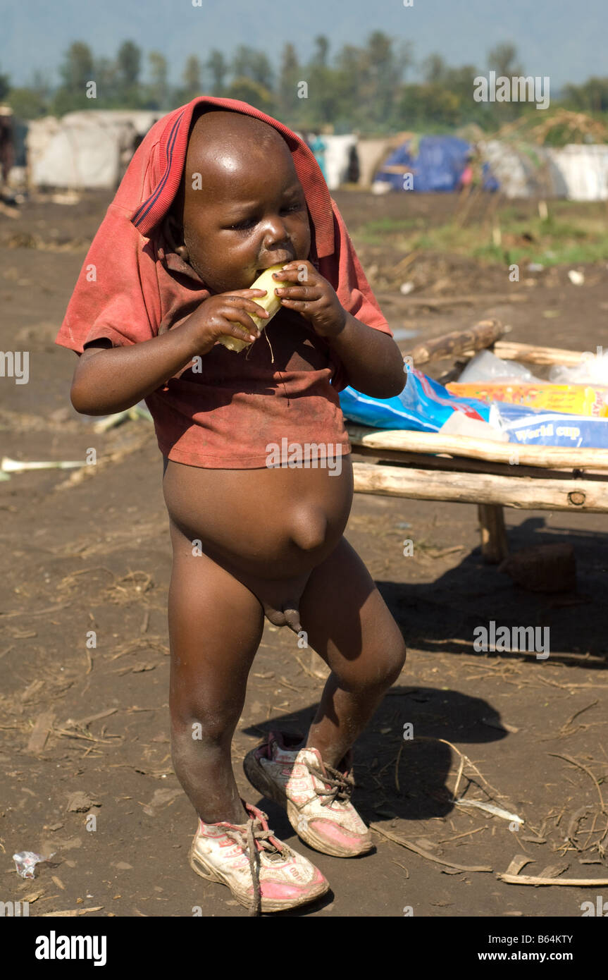 Starving Congolese child. Kiwange makeshift camp Stock Photo