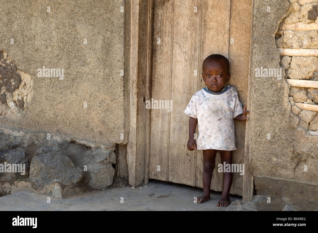 Traumatised Child, Kiwange, Congo Stock Photo
