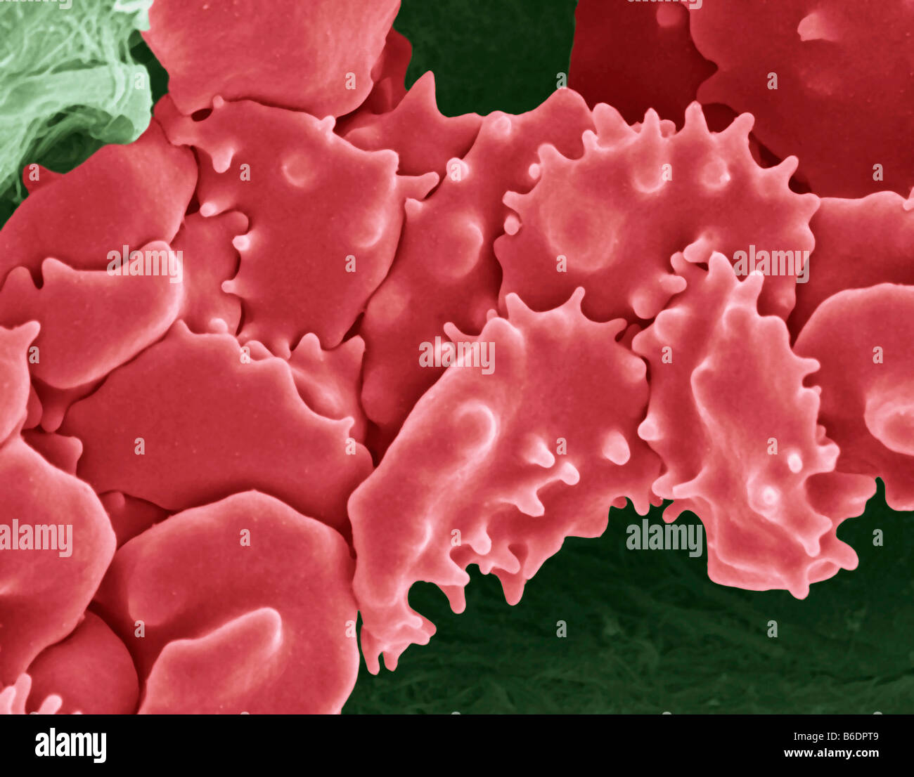 Crenated Blood Clot Coloured Scanning Electron Micrograph Sem Red Blood Cells Are Red And Fibrin Proteinstrands Are Green Stock Photo Alamy