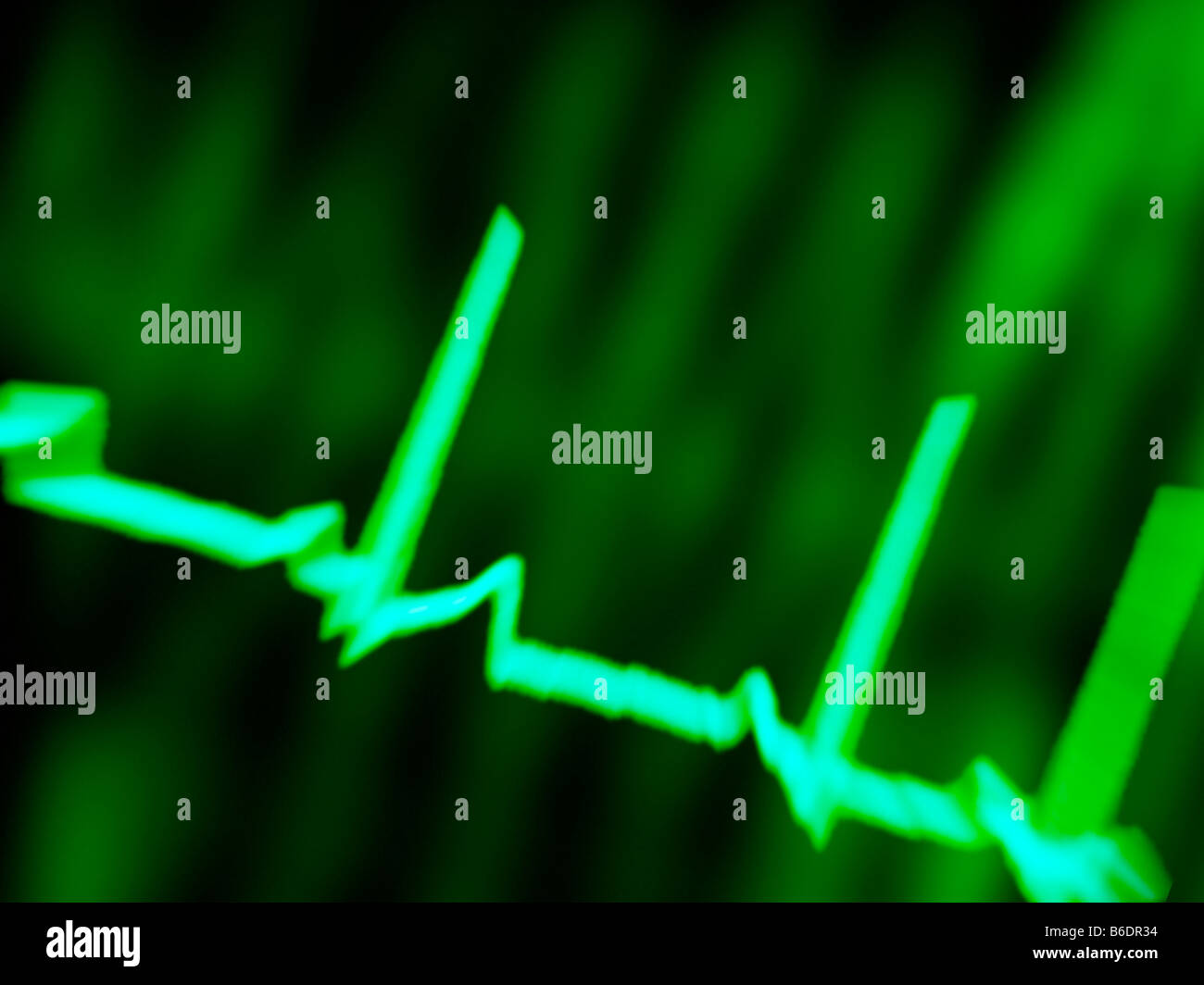 Electrocardiogram Ecg Medlineplus Medical Encyclopedi vrogue.co