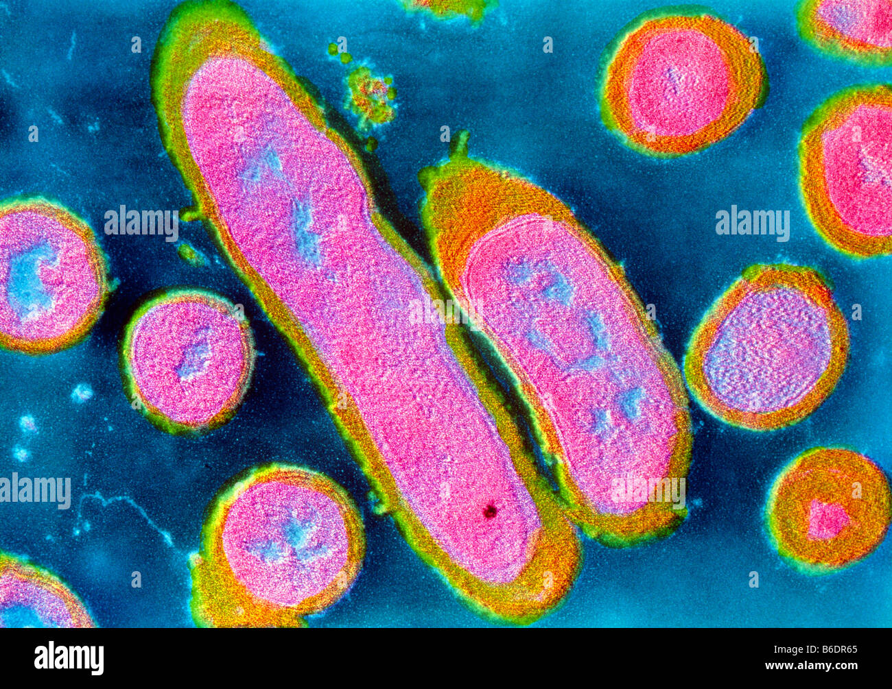 TEM of Erysipelothrix rhusiopathiae species of bacteria causing the skin disease Stock Photo