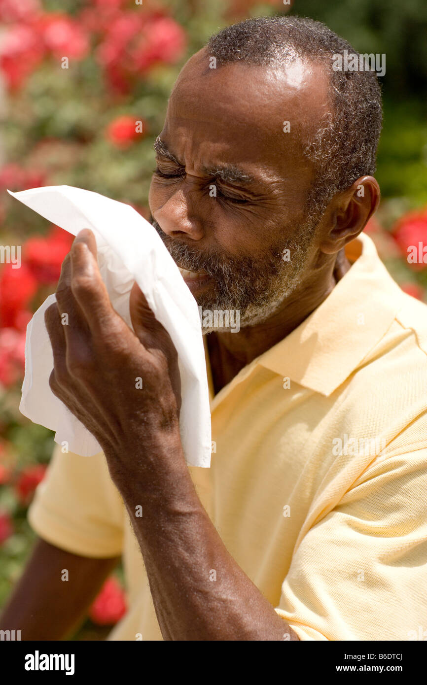 MODEL RELEASED.The allergic reactionin flames the membranes of the eyes