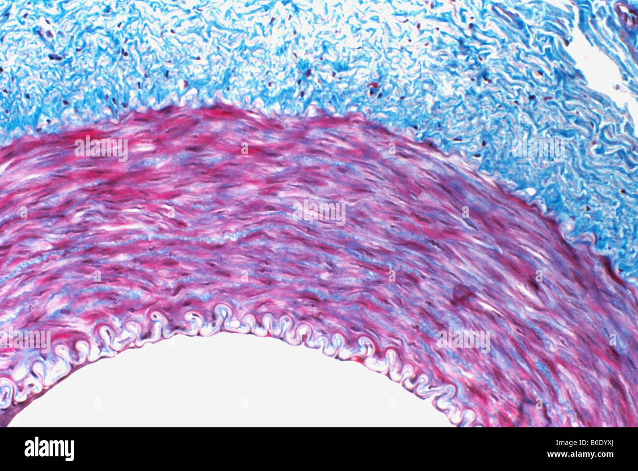 Muscular artery, Light micrograph of a transverse section through the