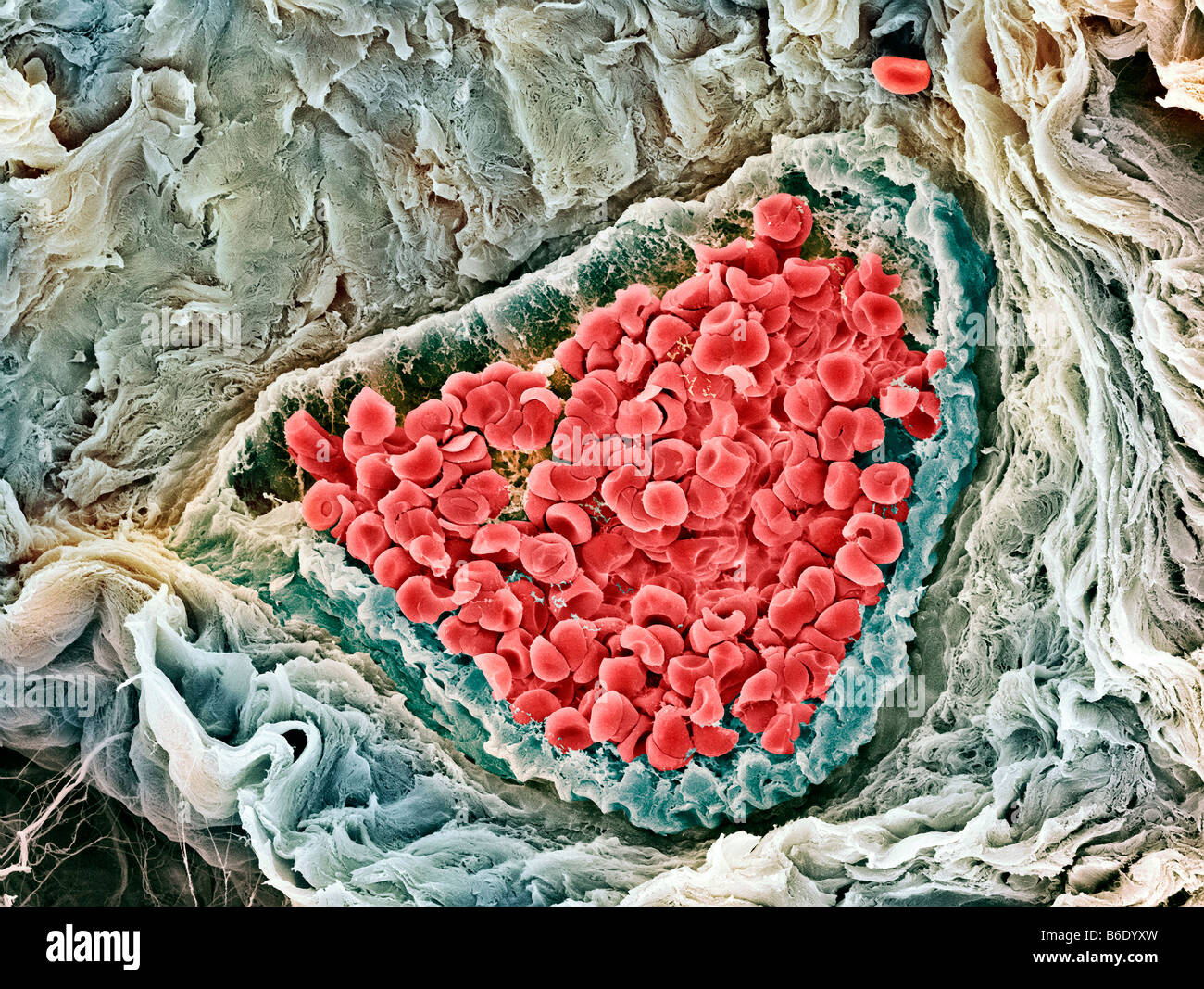 Red blood cells. Coloured scanning electron micrograph (SEM) of human red blood cells (erythrocytes). Stock Photo