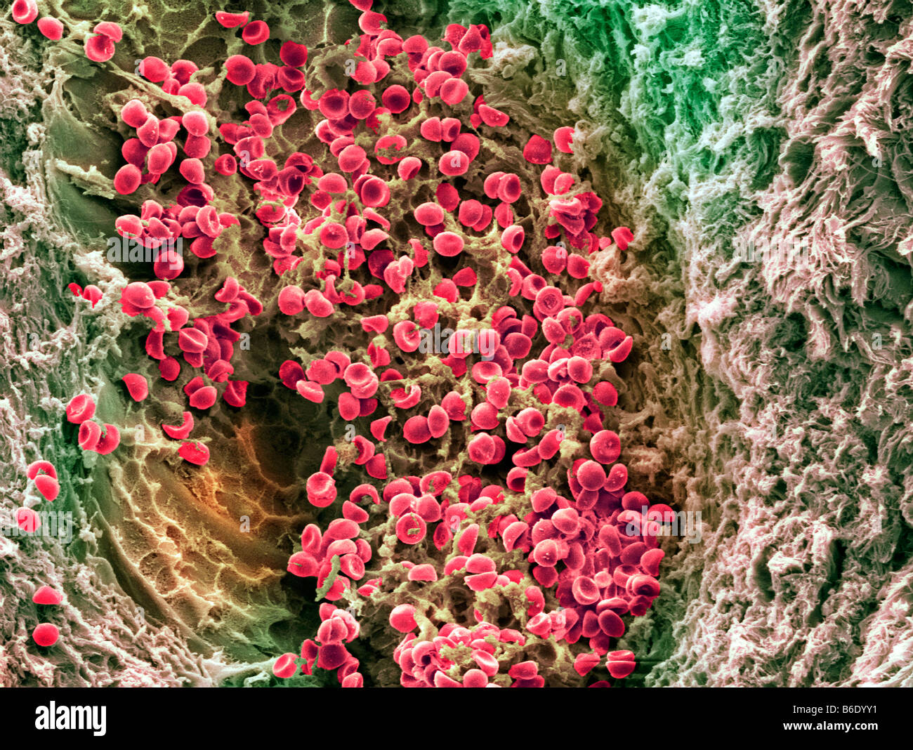 Blood clot, Coloured scanning electron micrograph (SEM) of blood clotting in an ovarian follicle. Stock Photo