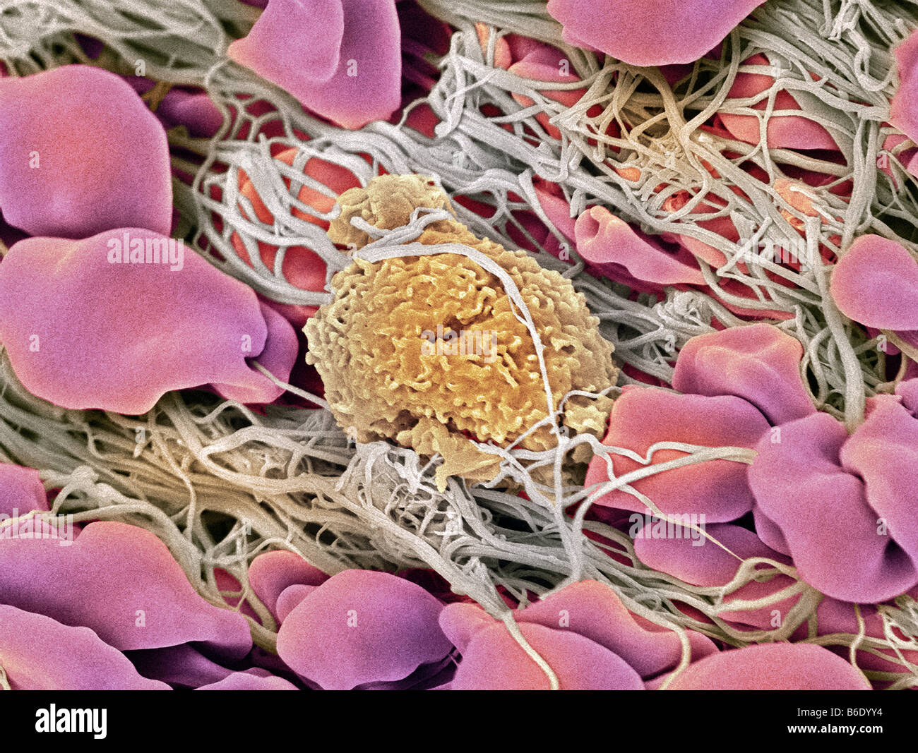 Blood clot, Coloured scanning electron micrograph (SEM) of blood clotting in an ovarian follicle. Stock Photo