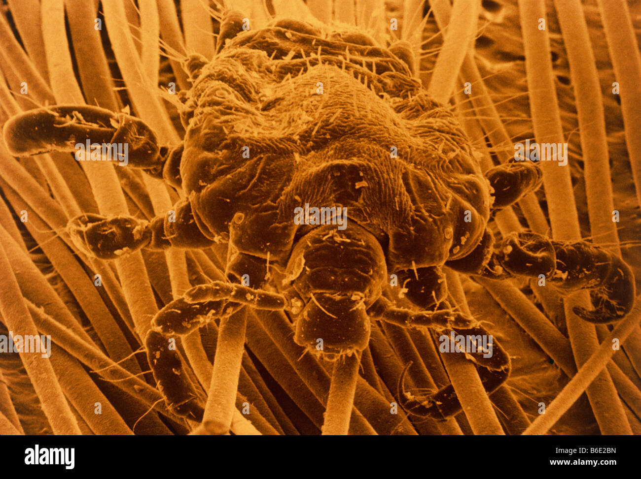 Pubic louse, Coloured scanning electron micrograph (SEM) of pubic louse Stock Photo