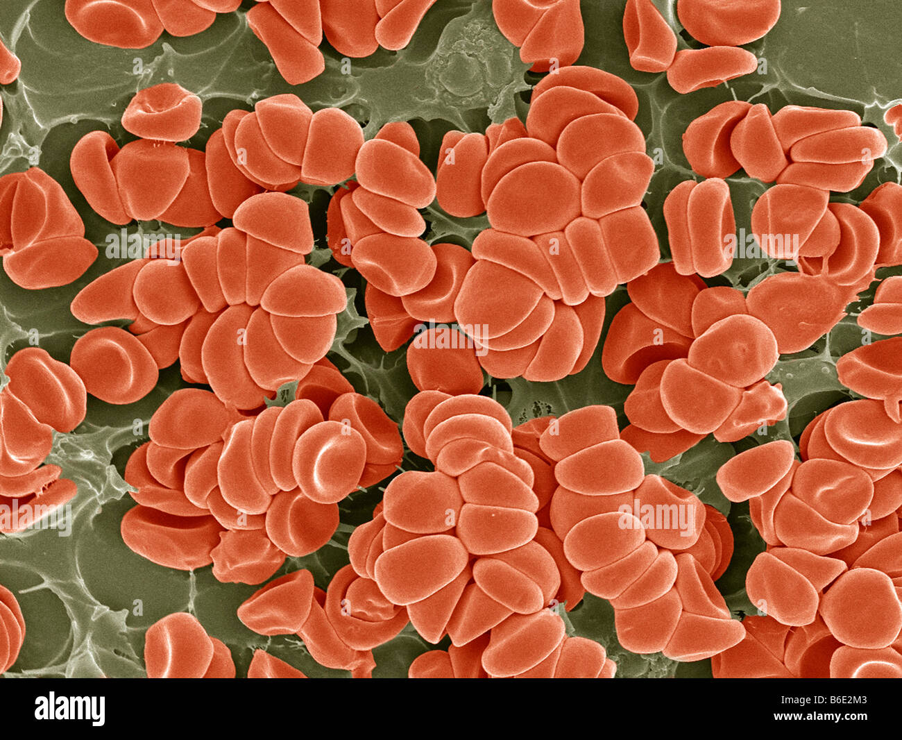 Blood clot. Coloured scanning electron micrograph (SEM) of red blood ...