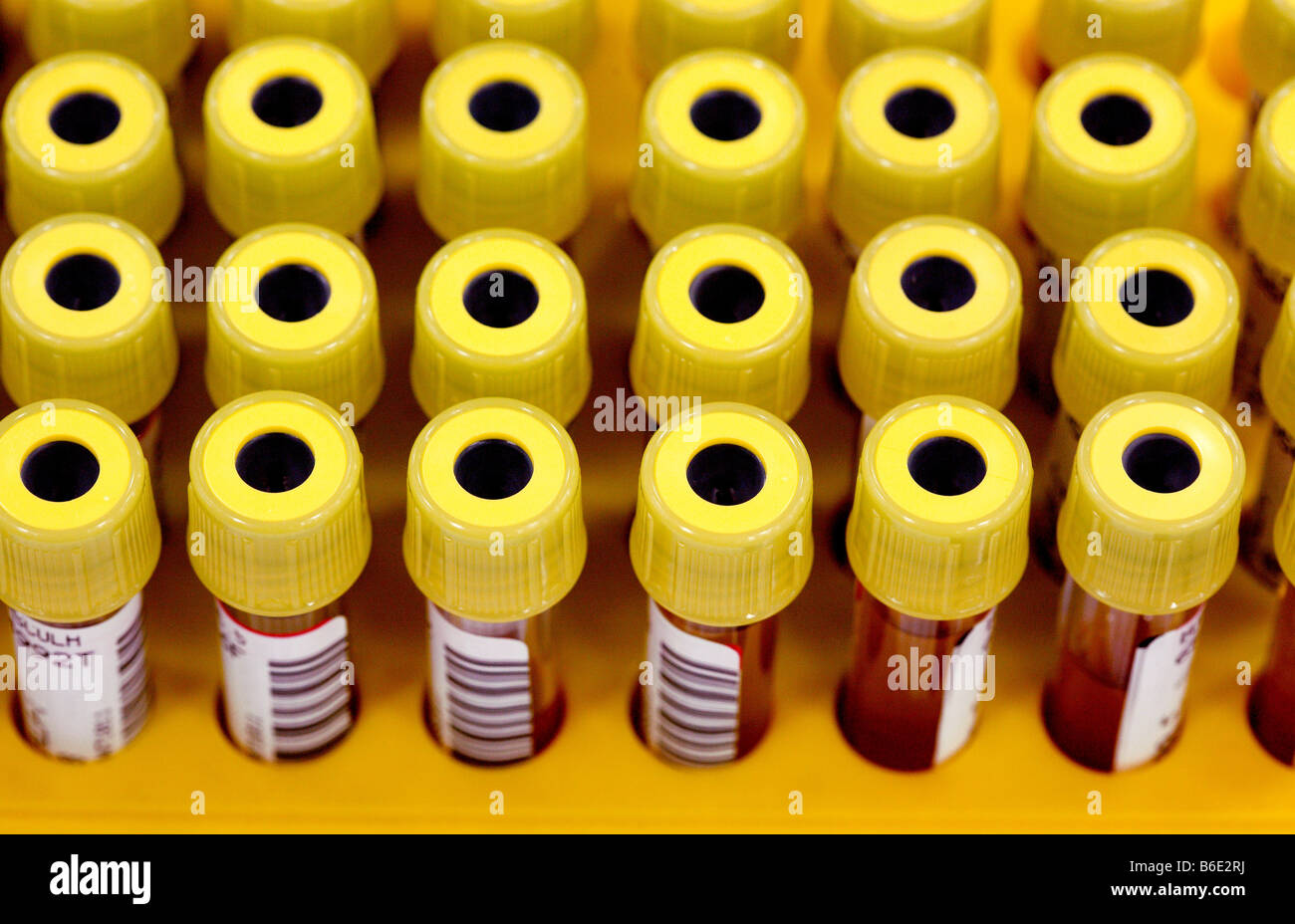 Blood samples. Barcoded vacutainer tubescontaining blood samples Stock