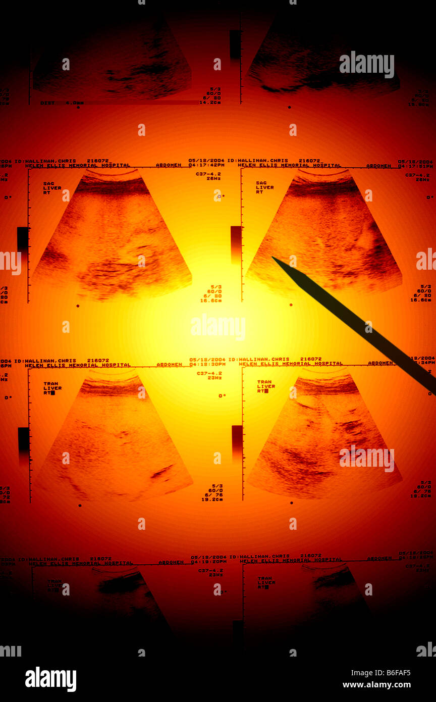 doctor pointing at ultrasound diagnostic screen of a heart Stock Photo