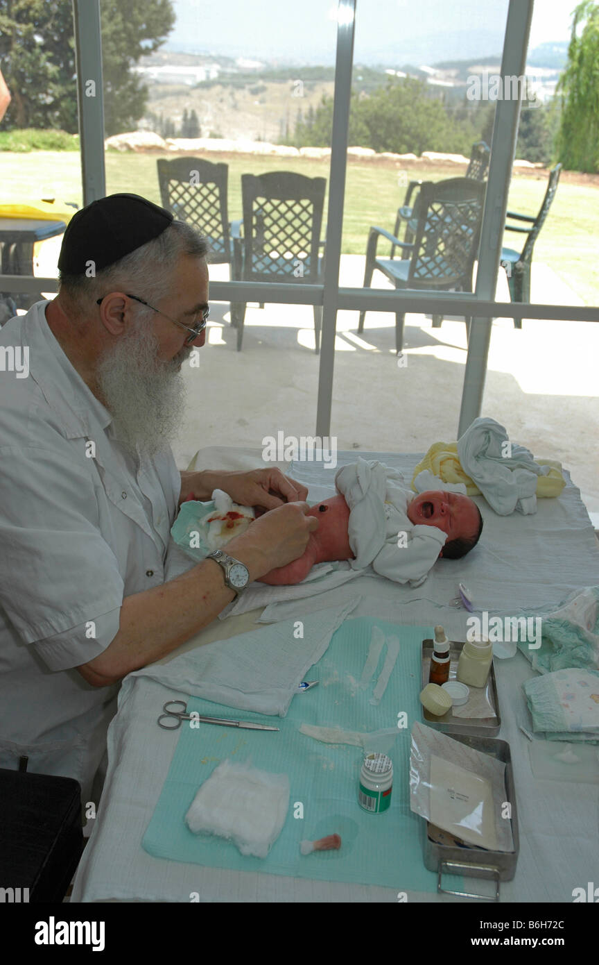 Circumcision Brit Mila Jewish Ceremony done when the baby boy is eight