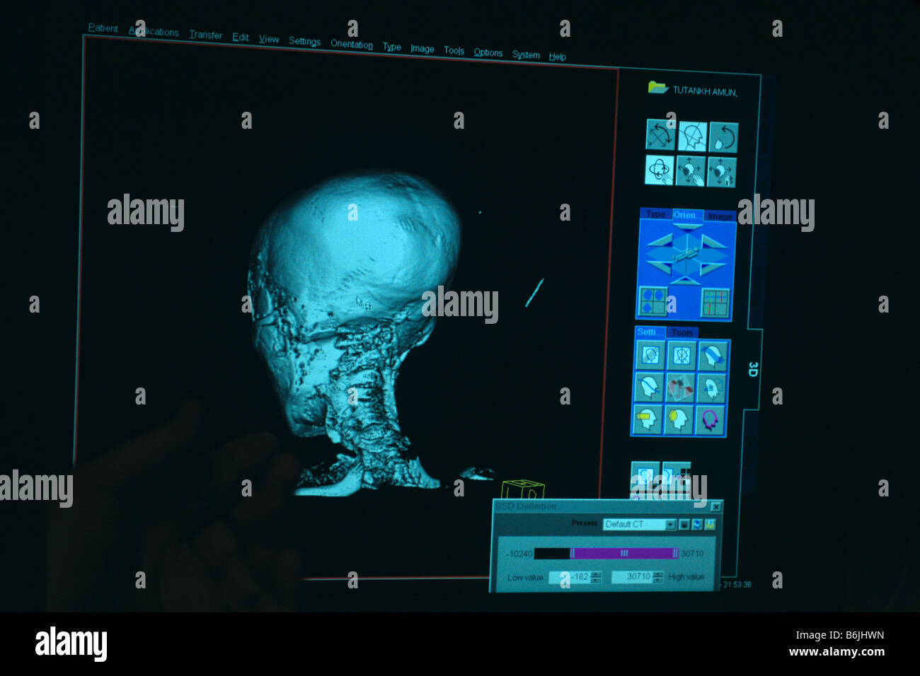 Egypt, CT scan monitor, test performed on mummy of Pharaoh Tutankhamun