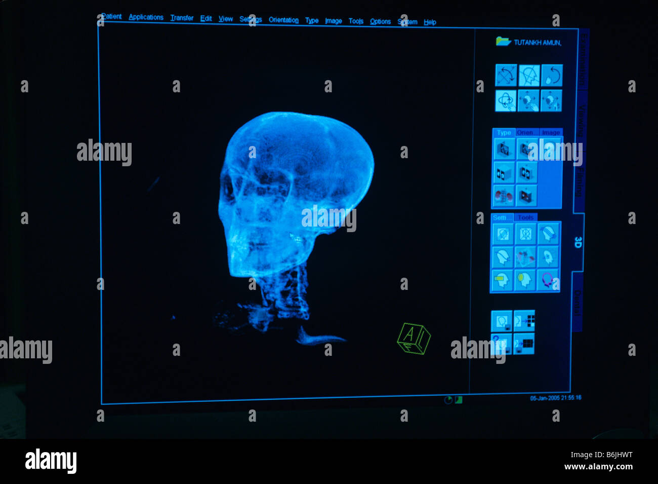 Egypt, CT scan monitor, test performed on mummy of Pharaoh Tutankhamun