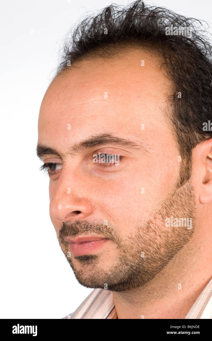 Thinning Hair Man Stock Photos Thinning Hair Man Stock Images