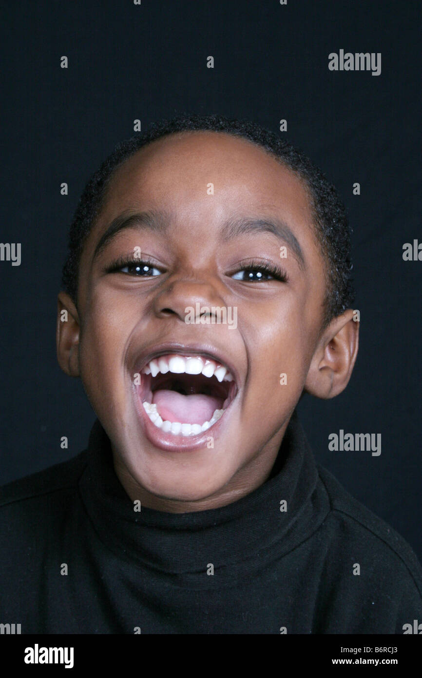 Boy with black eye hi-res stock photography and images - Alamy