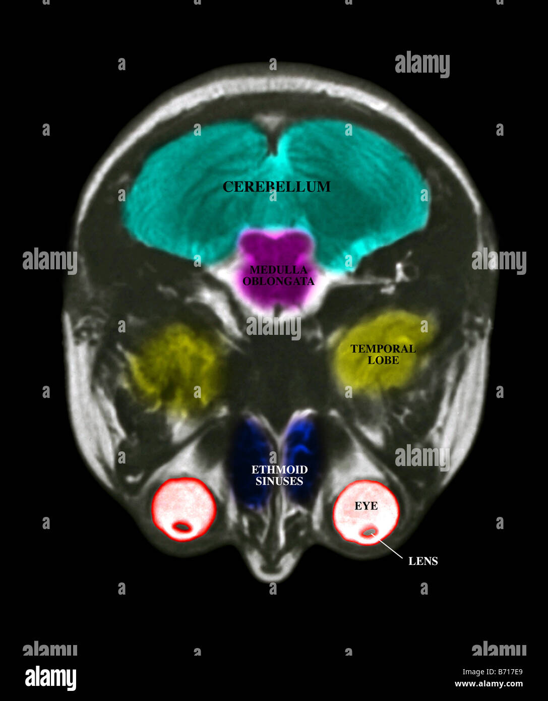 MRI scan of the brain, with the major structures labeled Stock Photo