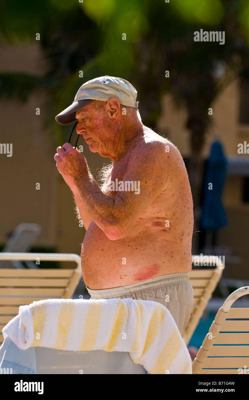 Palm Beach Shores , mature large portly older man in shorts bathing trunks & baseball cap puts on sunglasses by pool Stock Photo