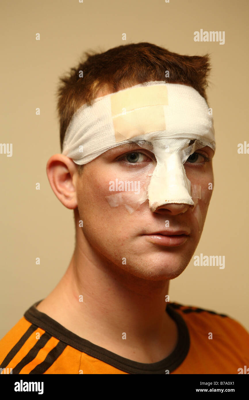 Nose bandage hires stock photography and images Alamy