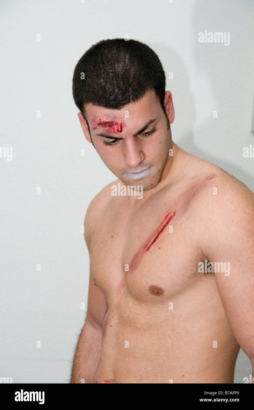 Seatbelt injury hires stock photography and images Alamy