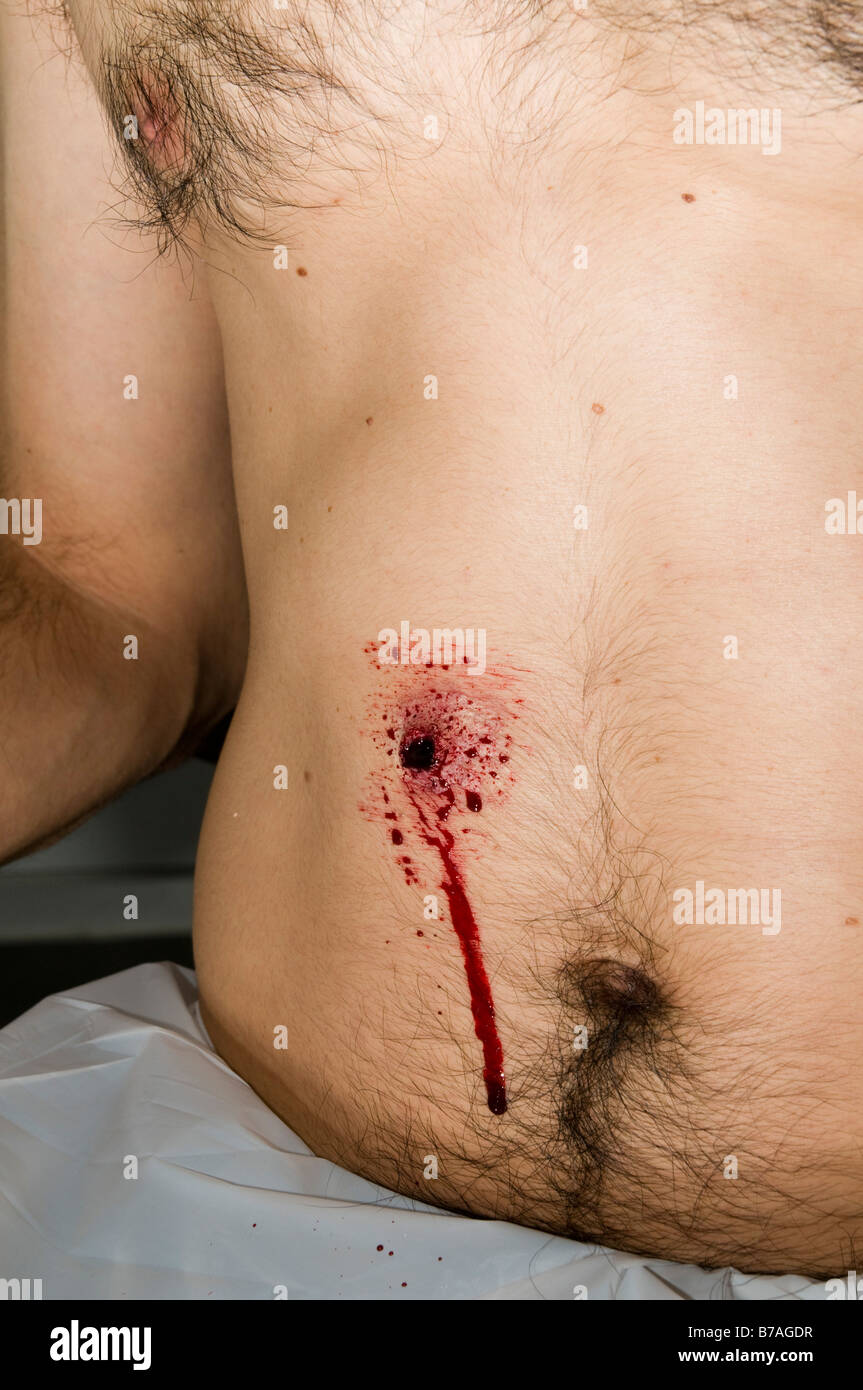 gunshot wounds to the chest