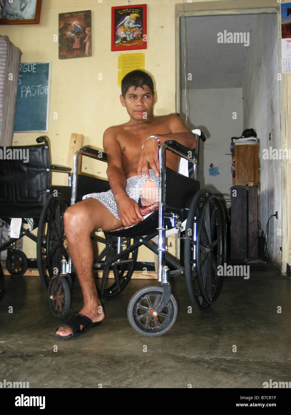 Illegal immigrant, attacked on the deathtrain, with amputated leg sitting in a wheelchair in hospice El Buen Pastor in Tapachul Stock Photo