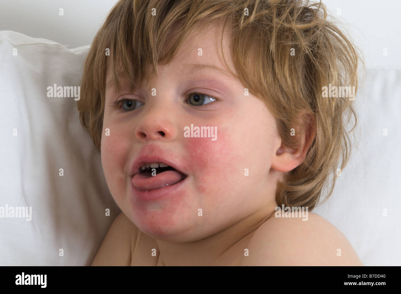 Cheeks cough hires stock photography and images Alamy