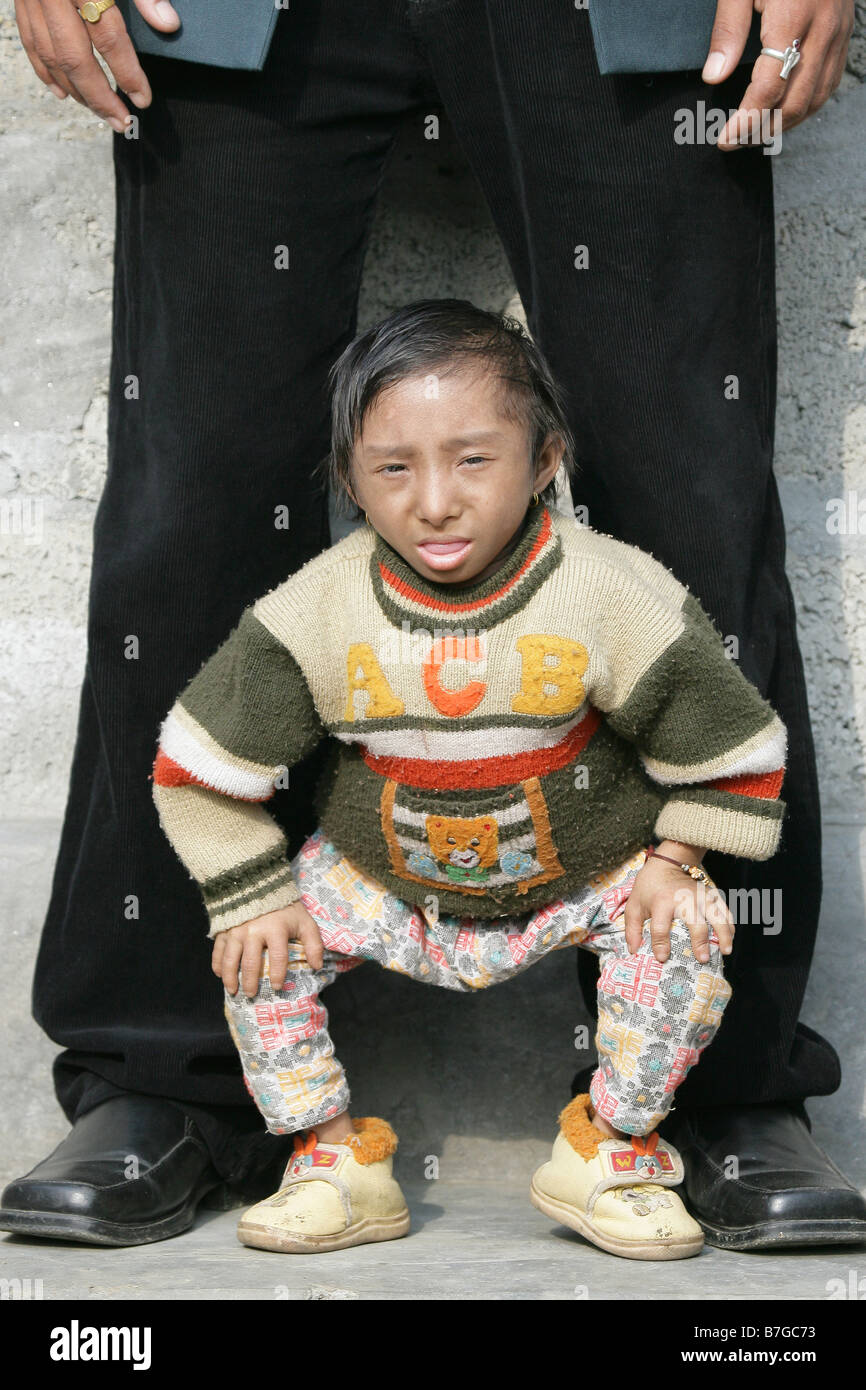 Eighteen year old Khagendra Thapa Magar the worlds smallest man Stock ...