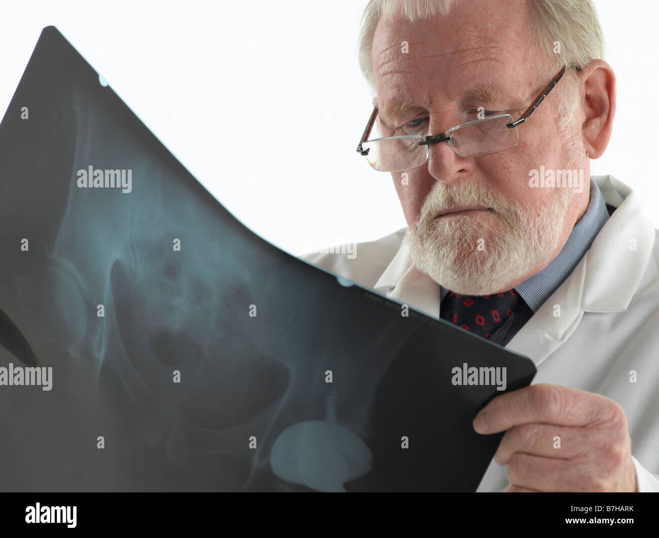DOCTOR WITH XRAY OF ARTIFICIAL HIP JOINT Stock Photo